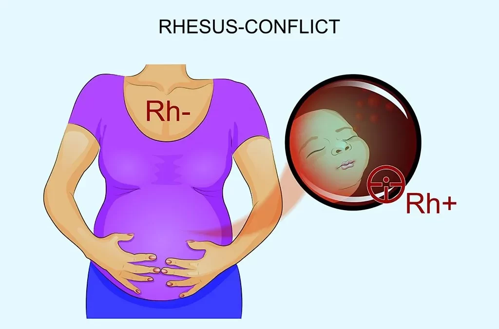 Understanding Rh Factor and Pregnancy: Protecting Your Baby’s Health